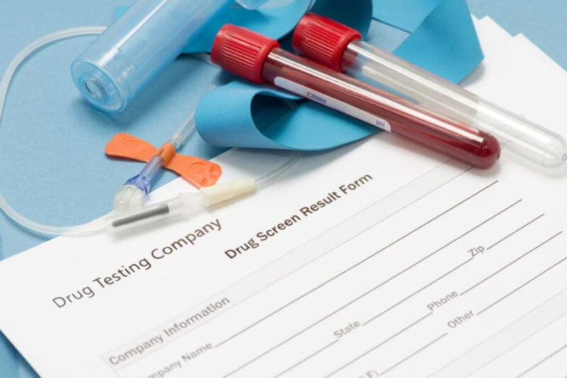 Safeguarding Operations After an Incident Drug Testing Protocols and Service Requirements