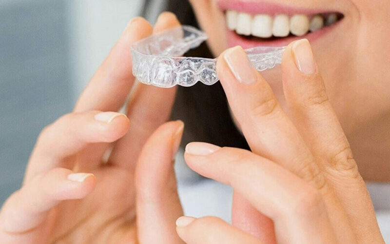 Daily Invisalign Care Tips That Help Kelowna Patients Stay on Track