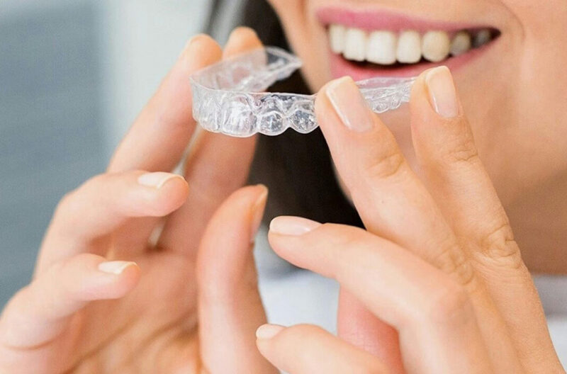 Daily Invisalign Care Tips That Help Kelowna Patients Stay on Track