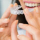 Daily Invisalign Care Tips That Help Kelowna Patients Stay on Track