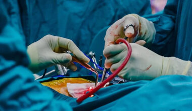 Renowned Pancreas Surgeons of Singapore