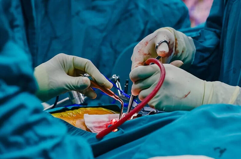 Renowned Pancreas Surgeons of Singapore