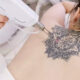 The Ultimate Guide to Tattoo Removal in 2026