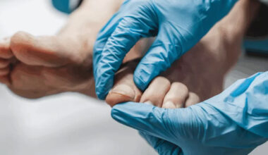 Expert Tips for Choosing a Podiatry Consultation in Singapore