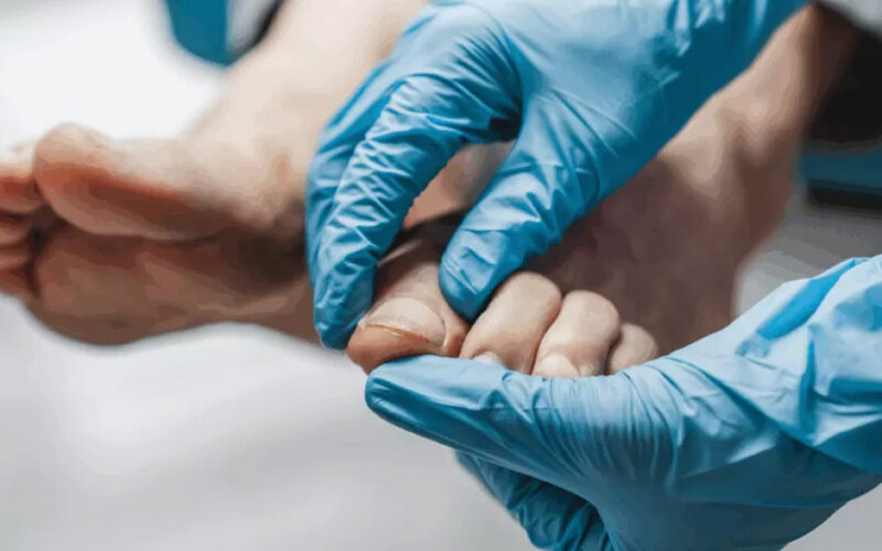 Expert Tips for Choosing a Podiatry Consultation in Singapore