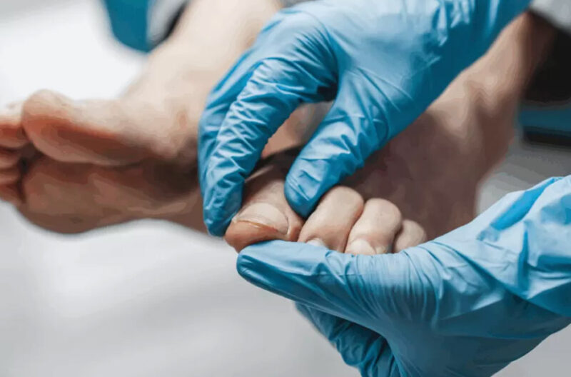 Expert Tips for Choosing a Podiatry Consultation in Singapore