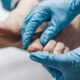 Expert Tips for Choosing a Podiatry Consultation in Singapore