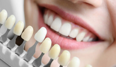 Key Reasons to Choose Dental Implants
