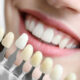 Key Reasons to Choose Dental Implants