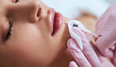 What to Expect During Your First Lip Injection Session in Utah