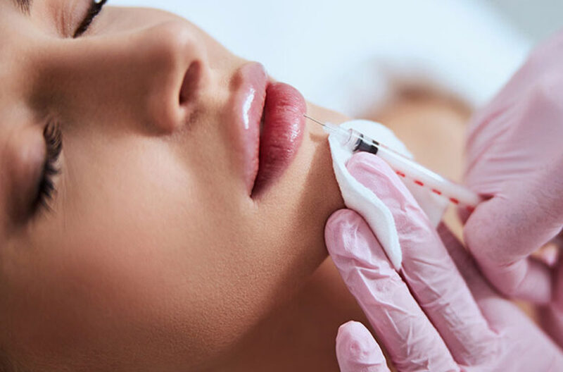 What to Expect During Your First Lip Injection Session in Utah