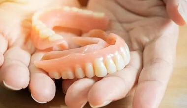Beyond Basic Dentures