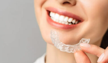 How Long Does Invisalign Treatment Take in Surrey