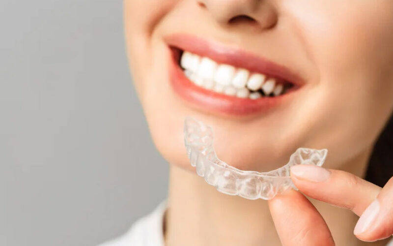 How Long Does Invisalign Treatment Take in Surrey