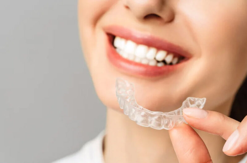 How Long Does Invisalign Treatment Take in Surrey