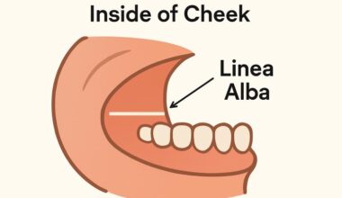 What Causes a White Line in Your Mouth and What Should You Do About It