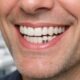 How to Maximize the Longevity of Dental Implants