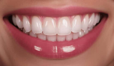 The Modern Magic of Dental Implants
