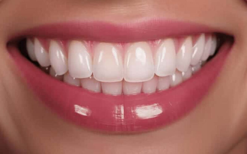 The Modern Magic of Dental Implants