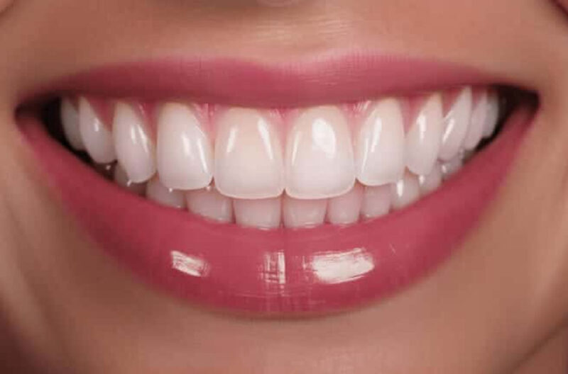 The Modern Magic of Dental Implants