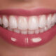 The Modern Magic of Dental Implants