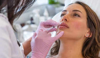 Comparing Different Filler Brands Used for Lip Enhancement