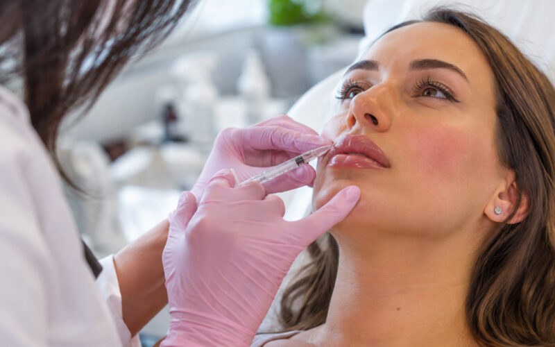 Comparing Different Filler Brands Used for Lip Enhancement